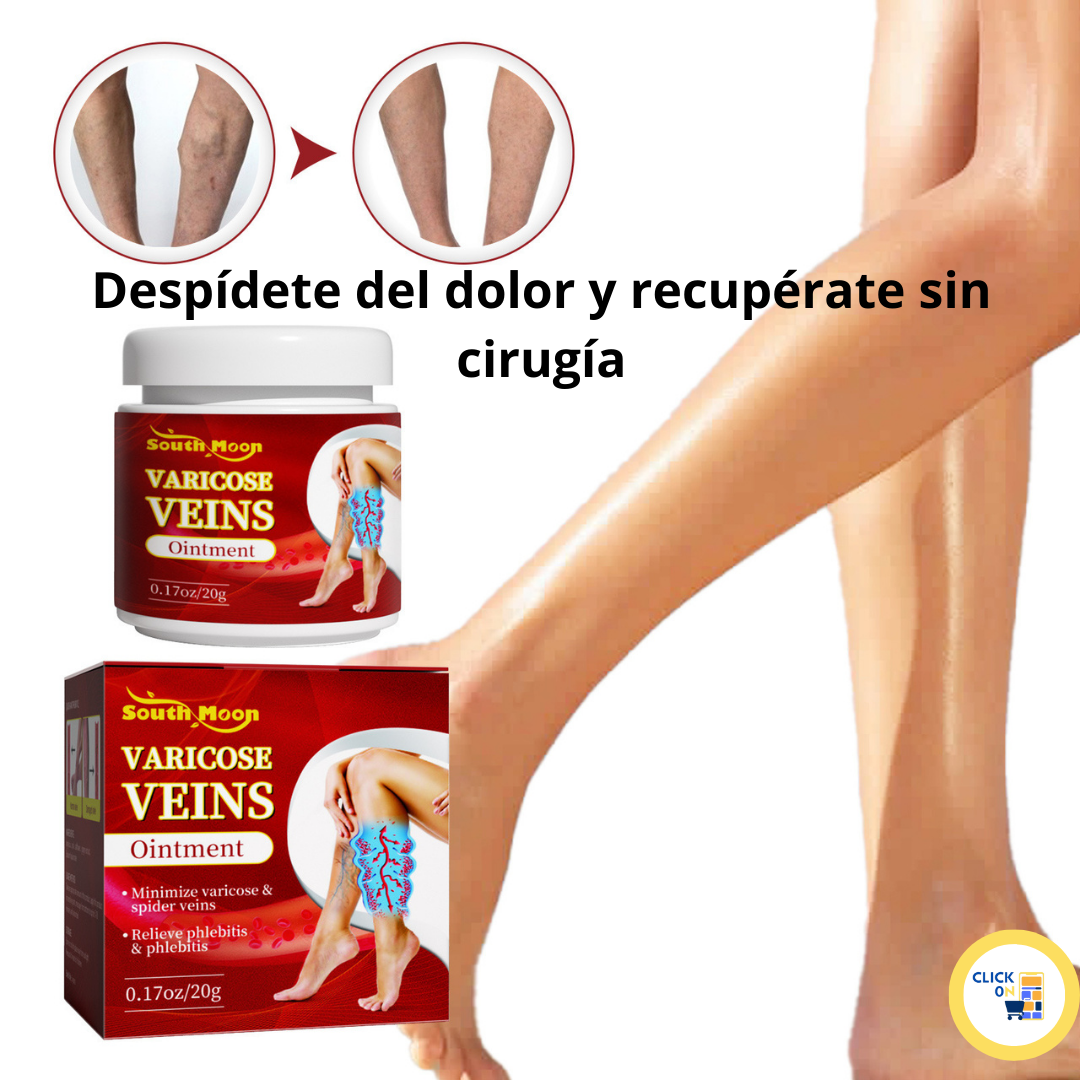 Varicose veins crema para varices