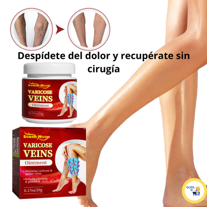 Varicose veins crema para varices